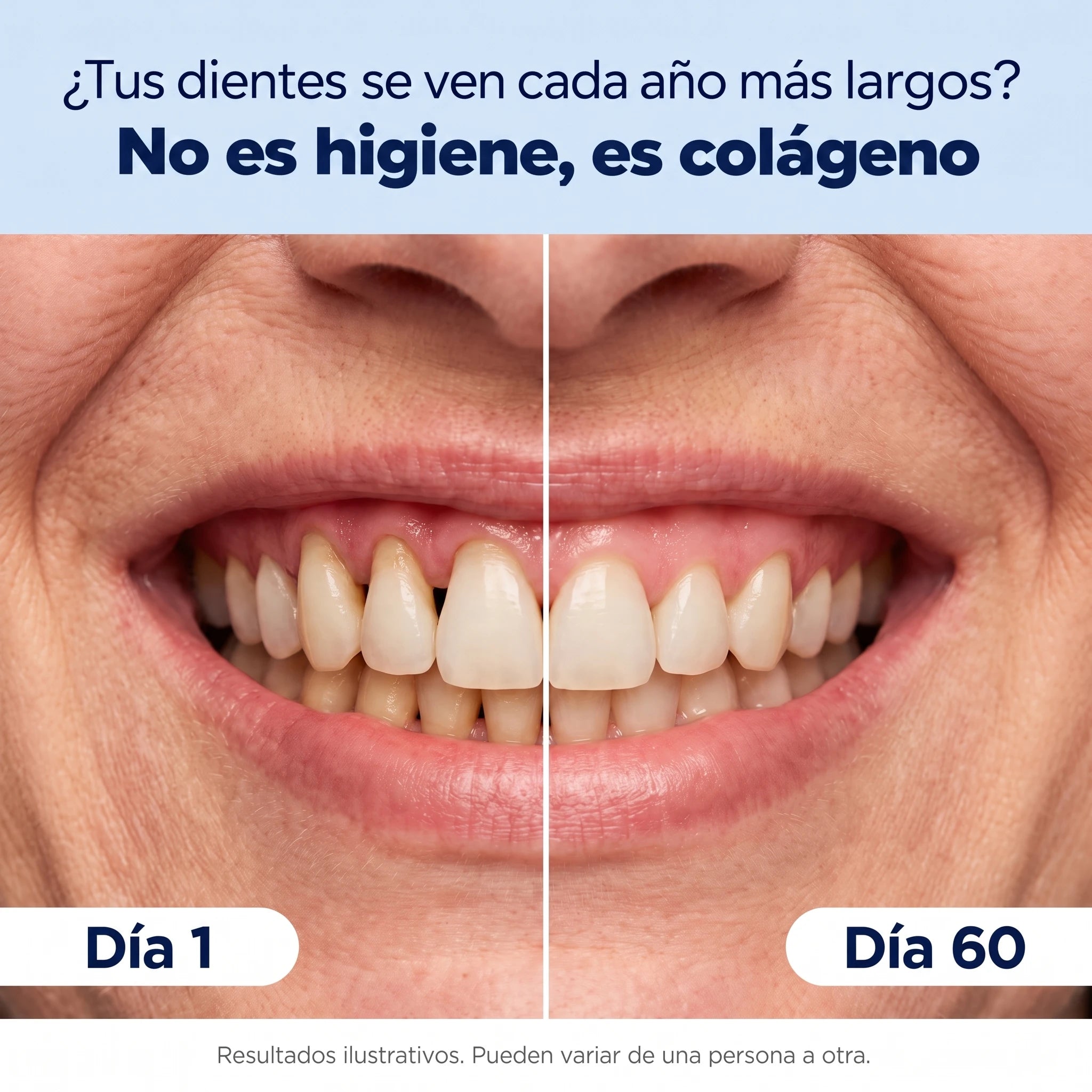 Dentiva - Terapia de Luz Roja