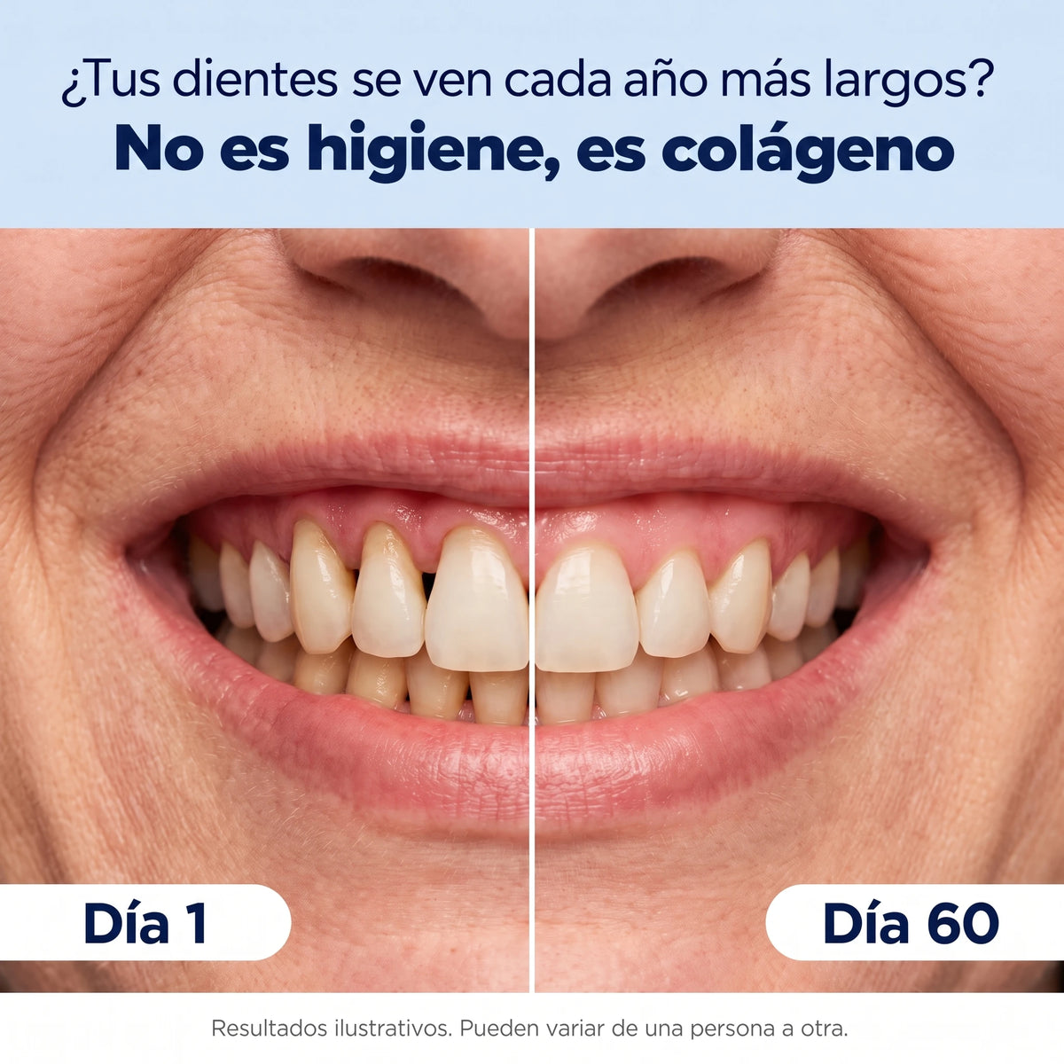 Dentiva - Terapia de Luz Roja